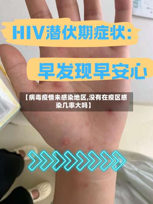 【病毒疫情未感染地区,没有在疫区感染几率大吗】-第3张图片